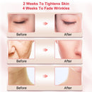 Radio Frequencia Beauty RF  -  LED terapia hifu Lifting Facial - Estimulador de Colágeno.