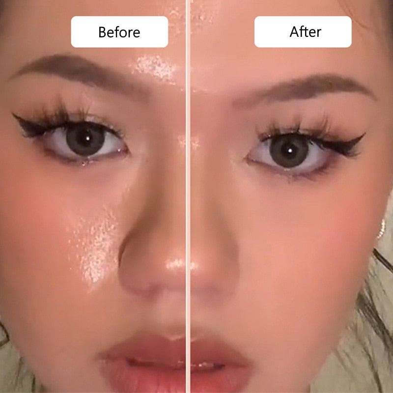 Rôlo Facial De Pedra Vulcânica - Reduz e Absorve Oleosidade.