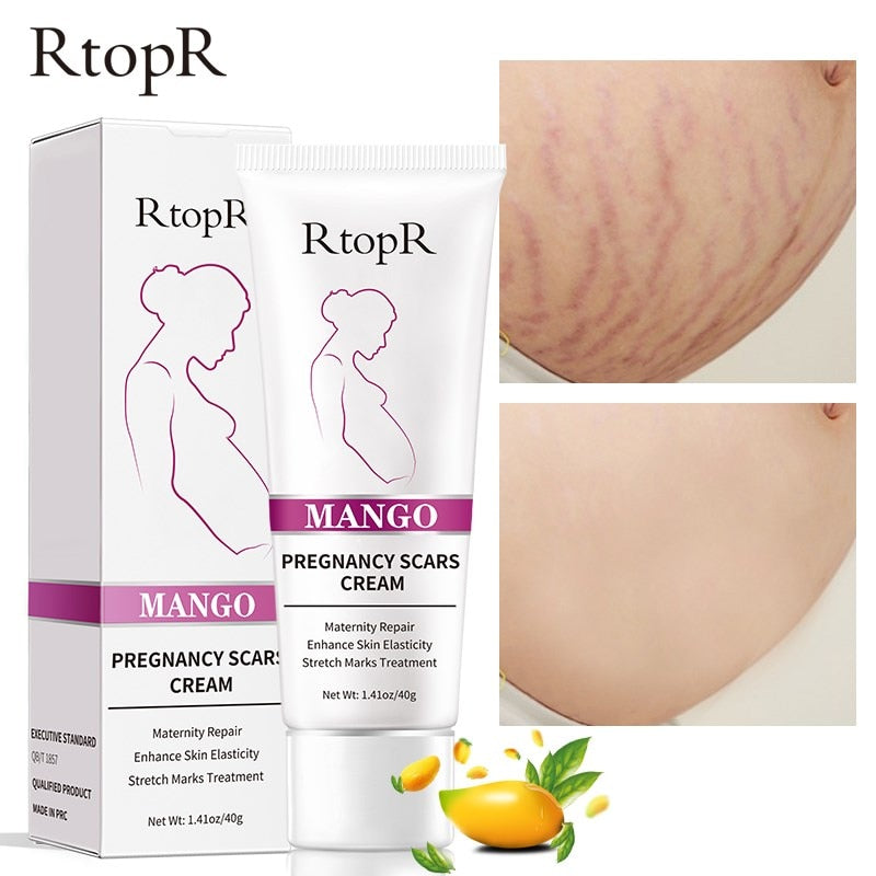 5pcs RtopR Mango - Melhora a Pele Reduz Rugas - Remove Cicatrizes e Estrias - Tratamento em Creme para a Pele Grávida - Aumenta  a Elasticidade da Pele.